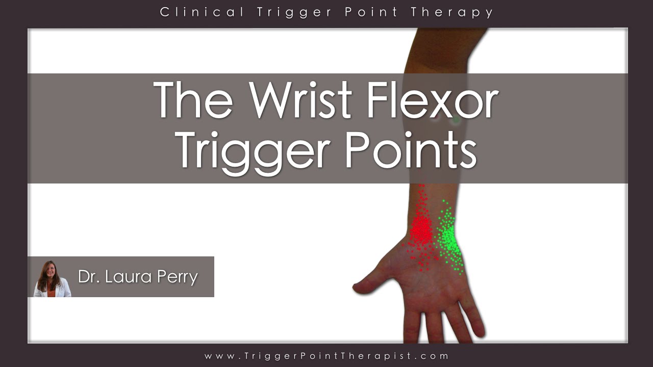 The Wrist Flexor Trigger Points