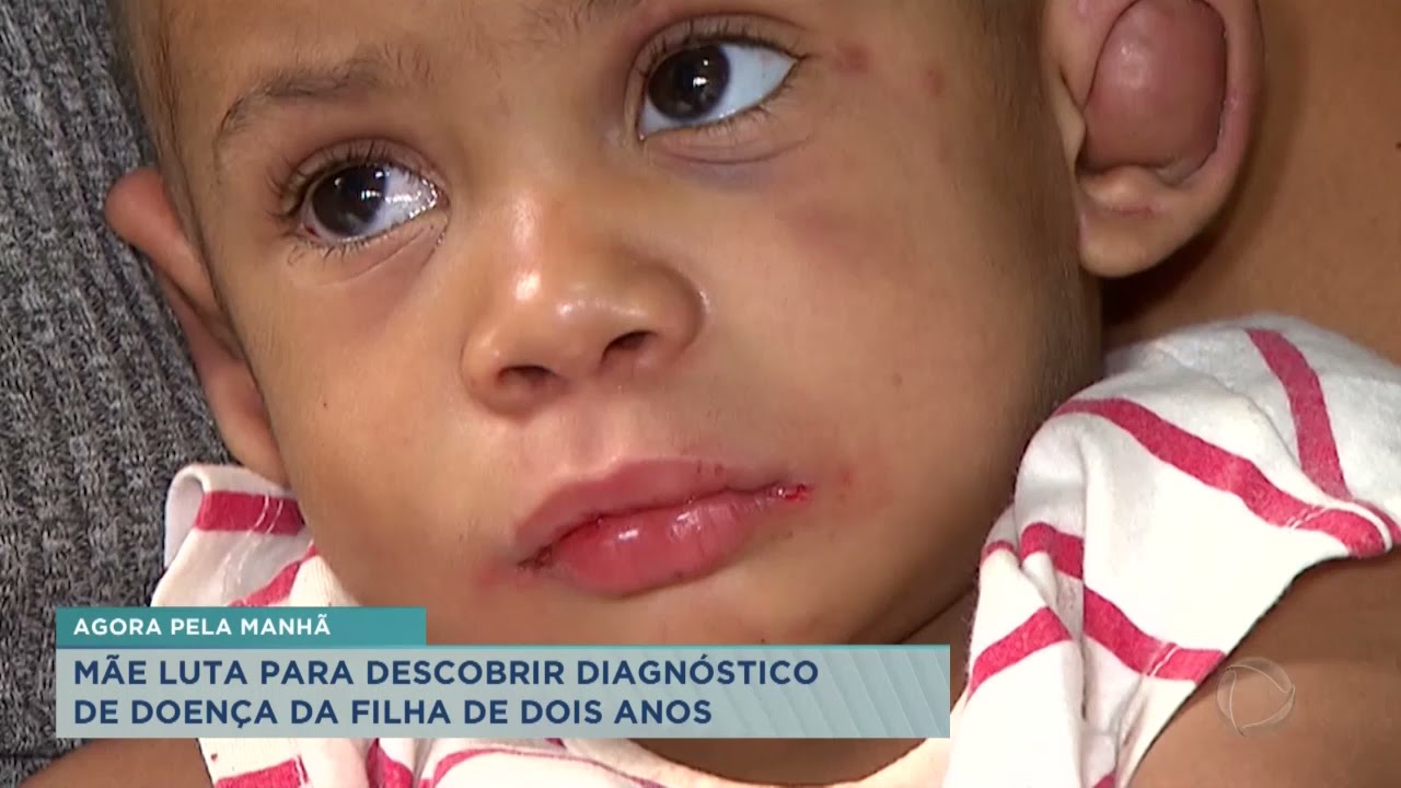 Mãe luta para descobrir diagnóstico de doença da filha