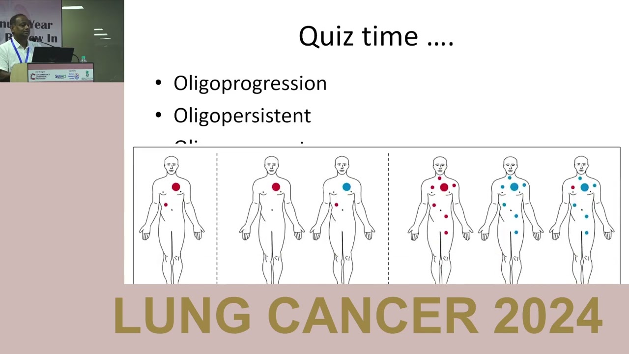 Panel Discussion : NSCLC Breakthroughs at WCLC 2024: ctDNA, RT, ICIs, LCT Trials | Updates