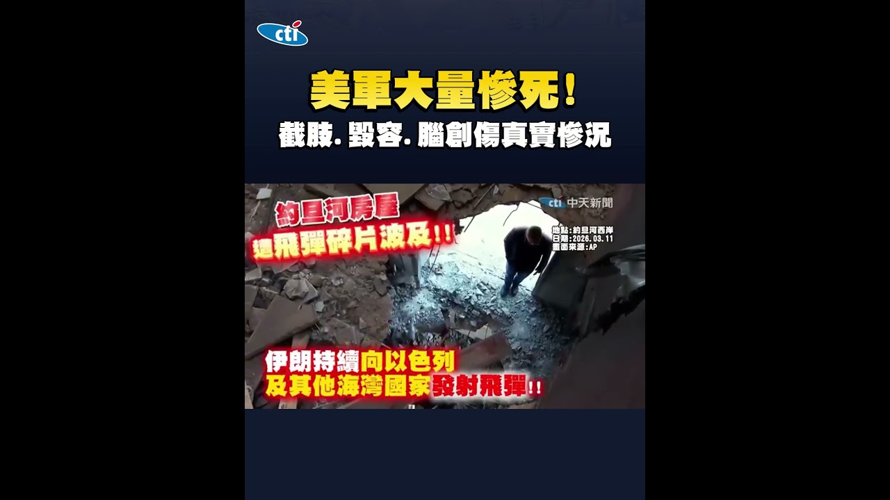 美軍大量慘死! 截肢.毀容.腦創傷