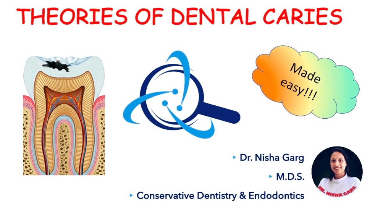 THEORIES OF DENTAL CARIES | W.D. MILLER | MADE EASY