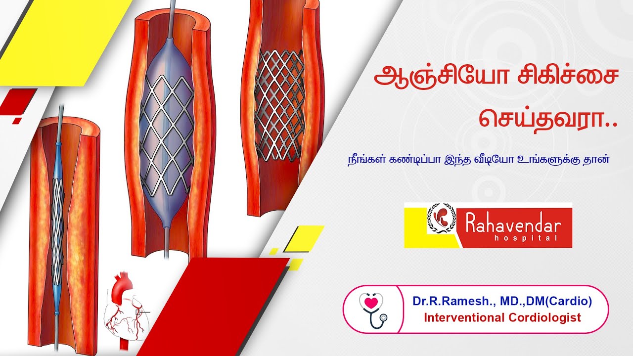 After Angioplasty | ஆஞ்சியோ பிளாஸ்டி சிகிச்சைக்கு பிறகு கடைபிடிக்க வேண்டியவை.