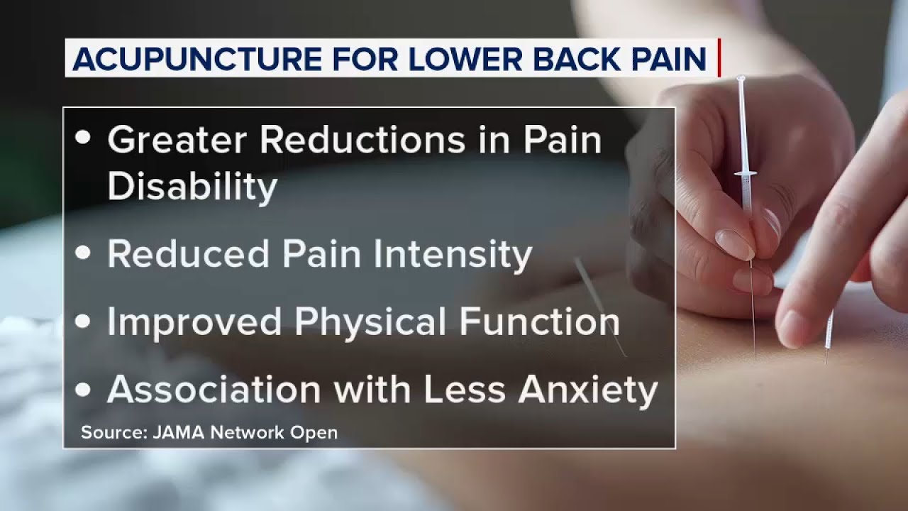 New report shows how the use of acupuncture helps with back pain