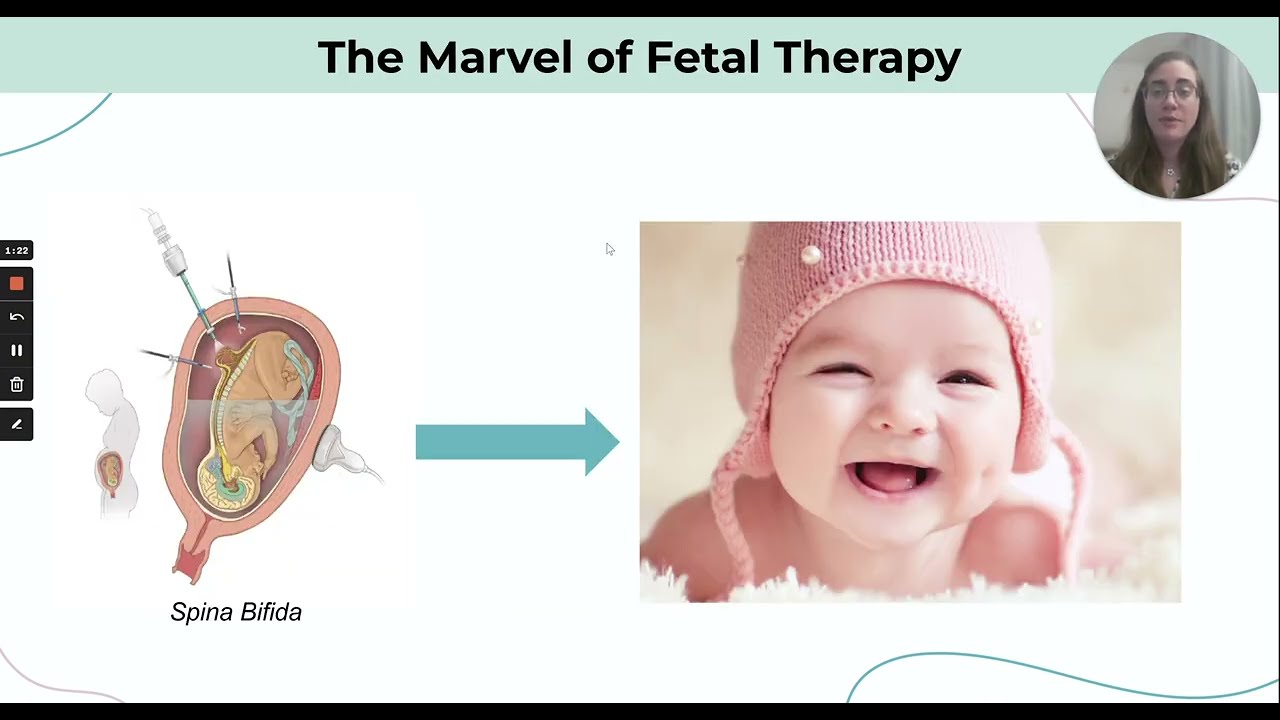 FastForward U Fall 2022 Spark Showcase - Fetal Therapy Technologies