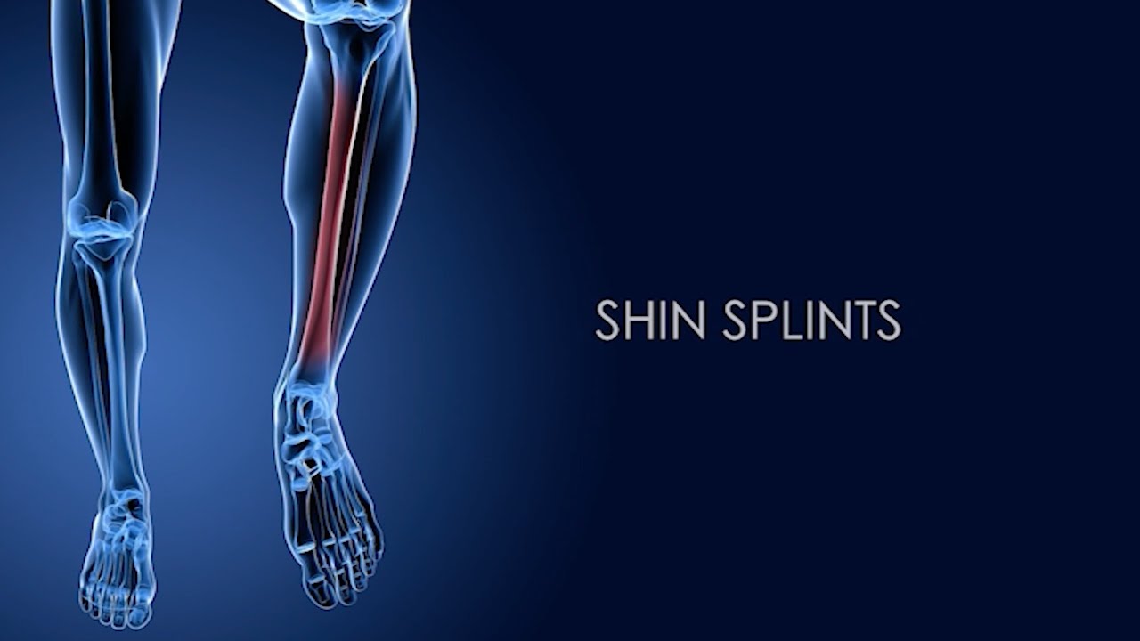 Kinesio Clinical Video Series: Sport Fitness for Shin Splints