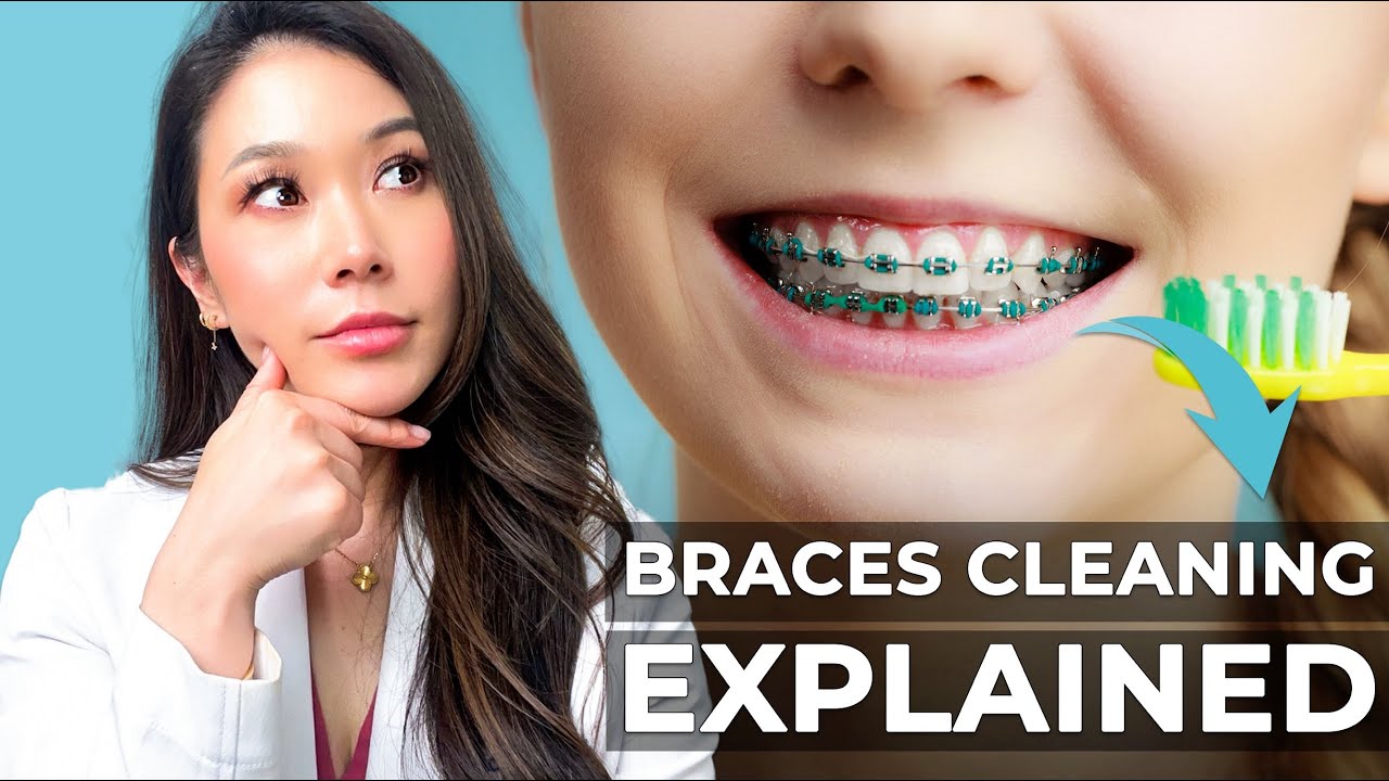 How to keep my braces clean