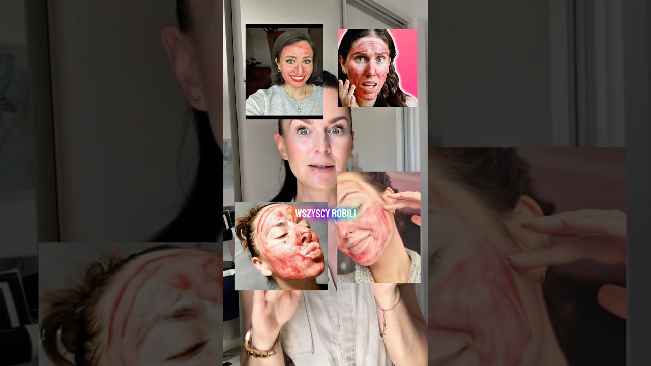 ‼️&rdquo;Krwawy peeling&rdquo;, kt&oacute;ry stał się rewolucją w domowym złuszczaniu? #theordinary #kultowykosmetyk