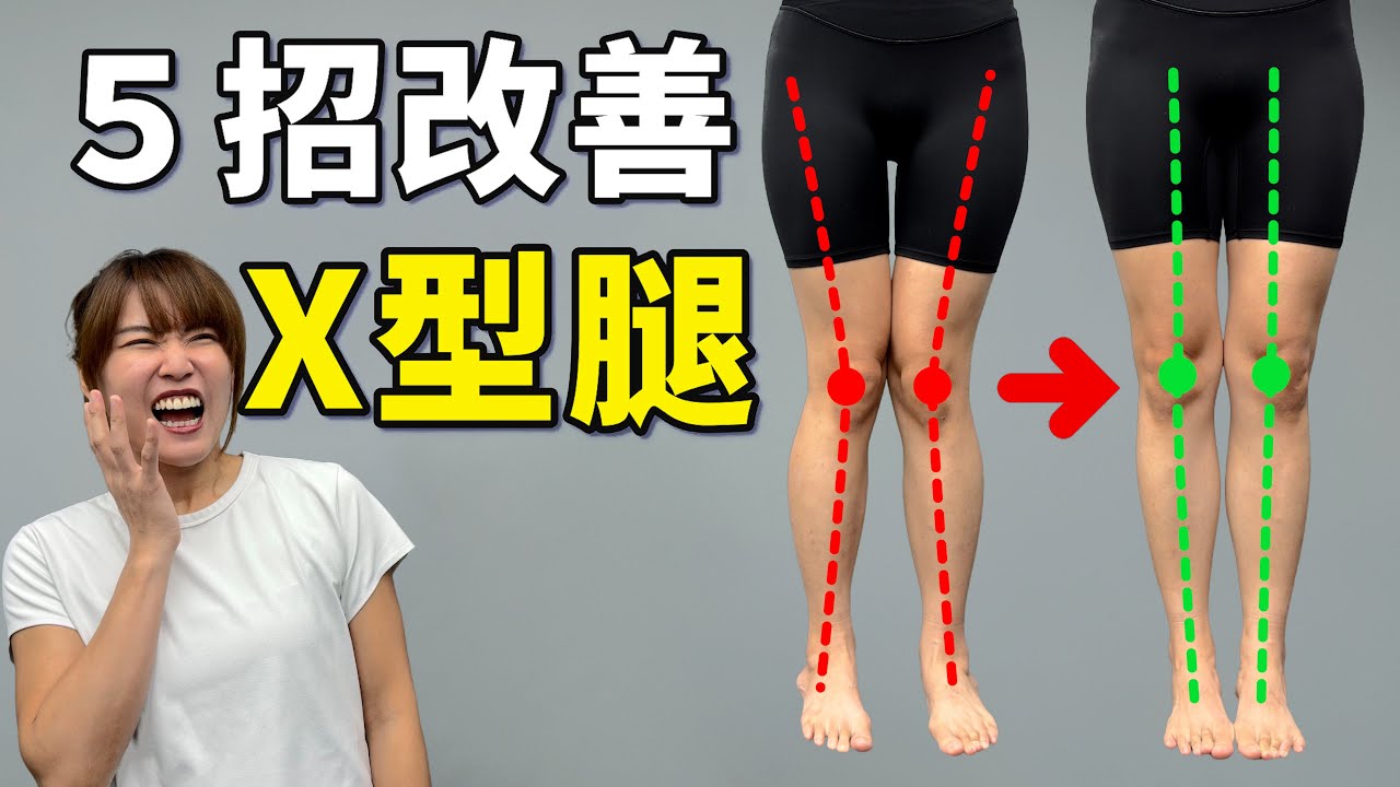 「這些習慣」傷膝蓋！久坐、內八養出 X 型腿，5招教你「喬」回直腿｜#啾c物理治療師 #運動治療 #X型腿 #膝蓋
