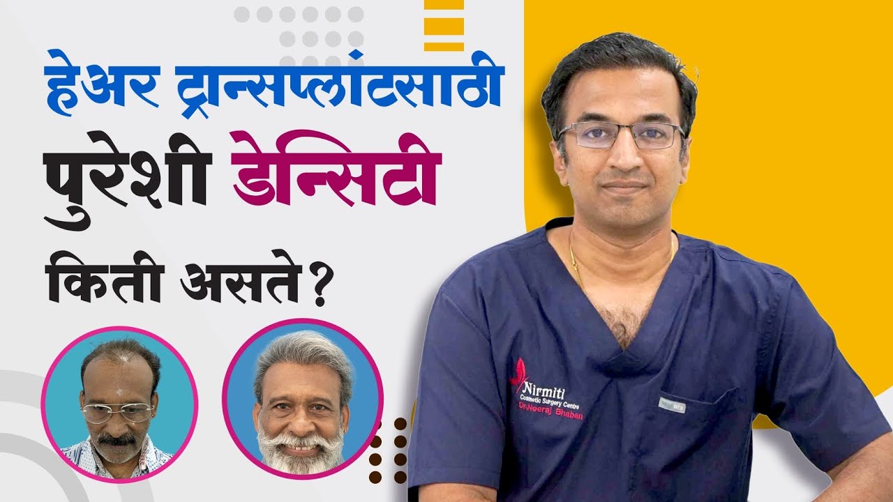हेअर ट्रान्सप्लांटसाठी पुरेशी डेन्सिटी किती असते ? | By - Dr. Neeraj Bhaban