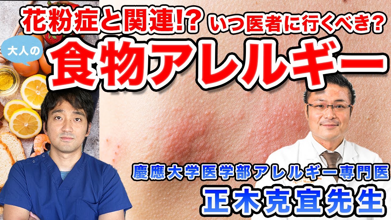 大人の食物アレルギー 原因、症状や検査、対応について【アレルギー専門医が詳しく解説】