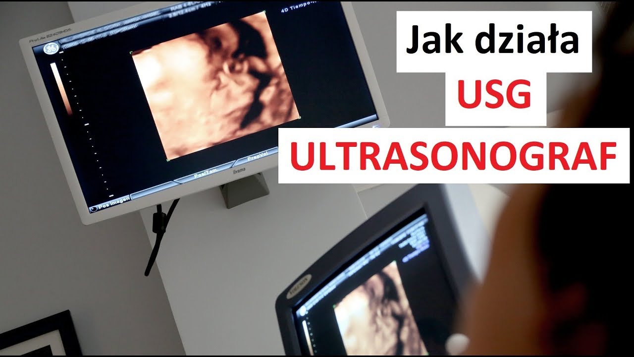 Jak działa USG - ULTRASONOGRAF