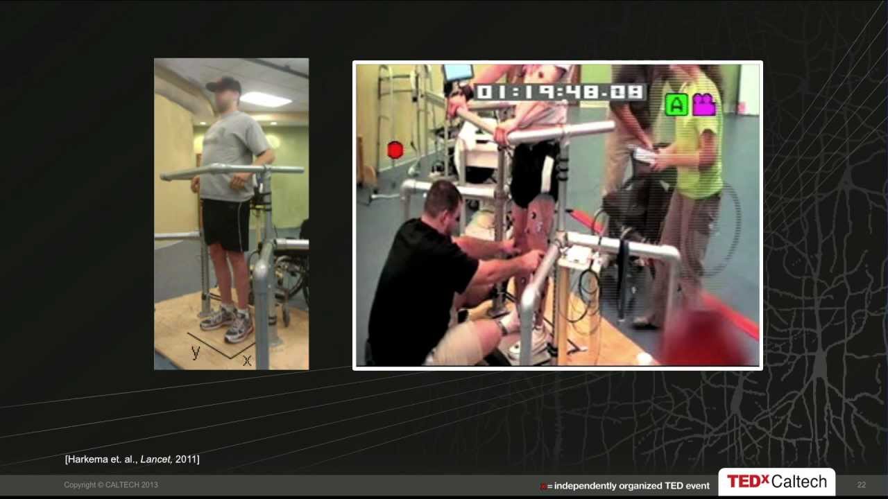 Human Prosthetics for Paralysis: Joel Burdick at TEDxCaltech