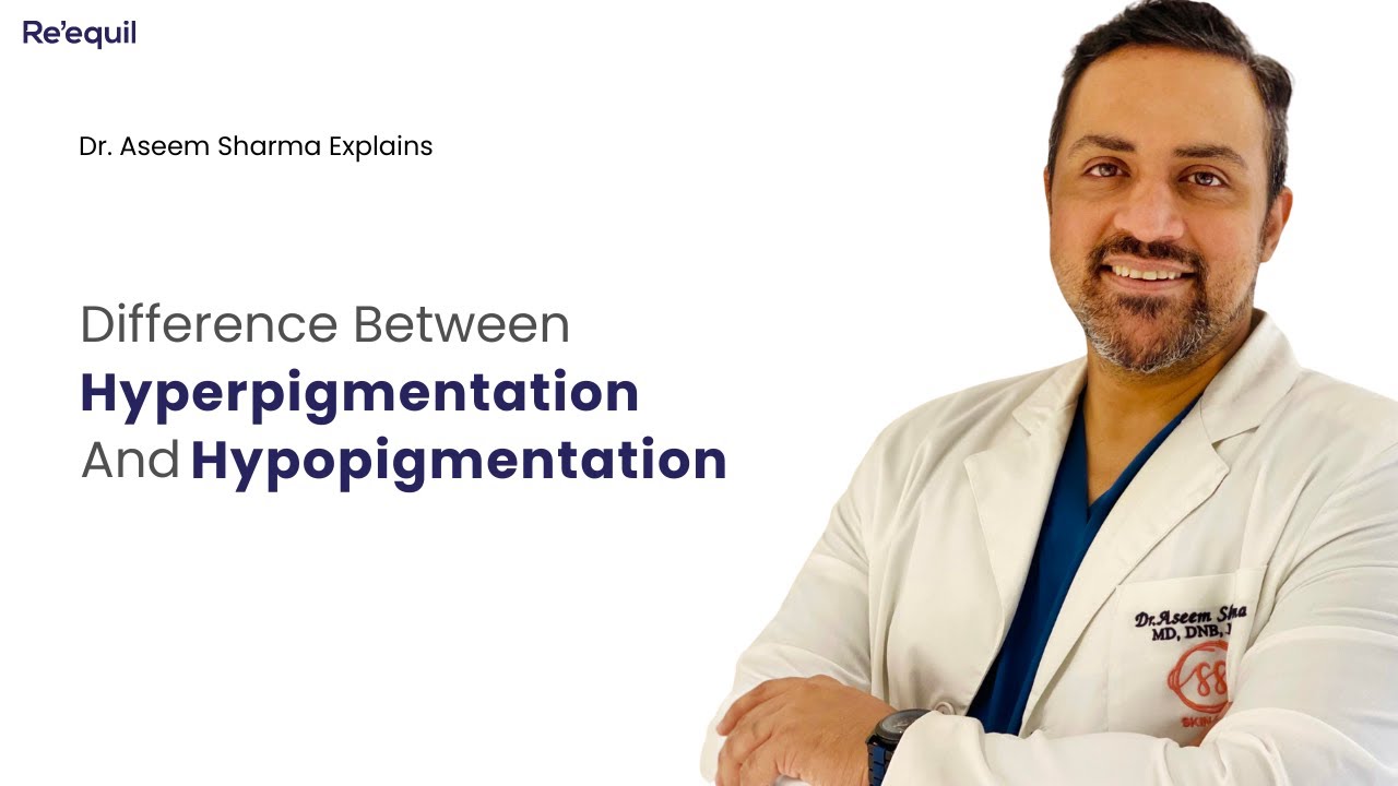 Difference Between Hyperpigmentation And Hypopigmentation - By Dr Aseem Sharma
