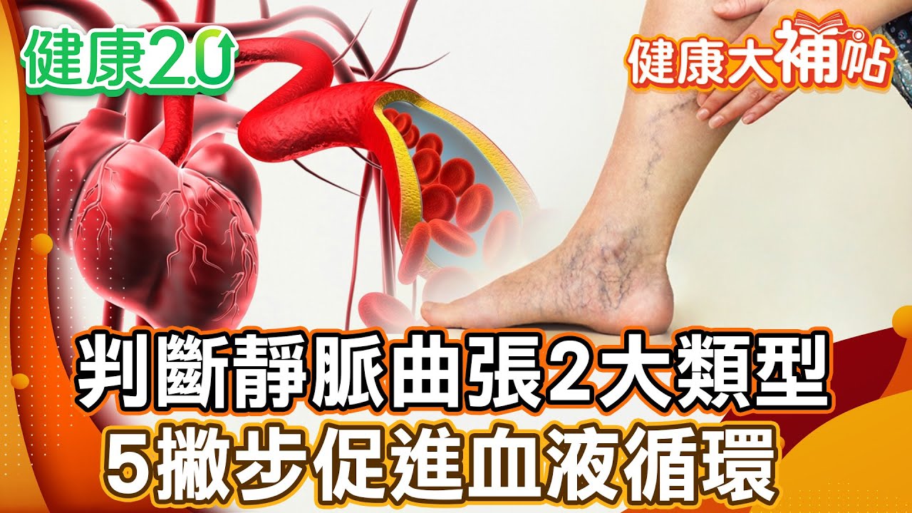 久站、久坐容易靜脈曲張 醫師教判斷靜脈曲張2大類型！2招下肢運動  超簡單隨時可以做！3秘訣助靜脈回流！【#健康大補帖】健康2.0 #鄭凱云 #陳欣湄  #韋汝