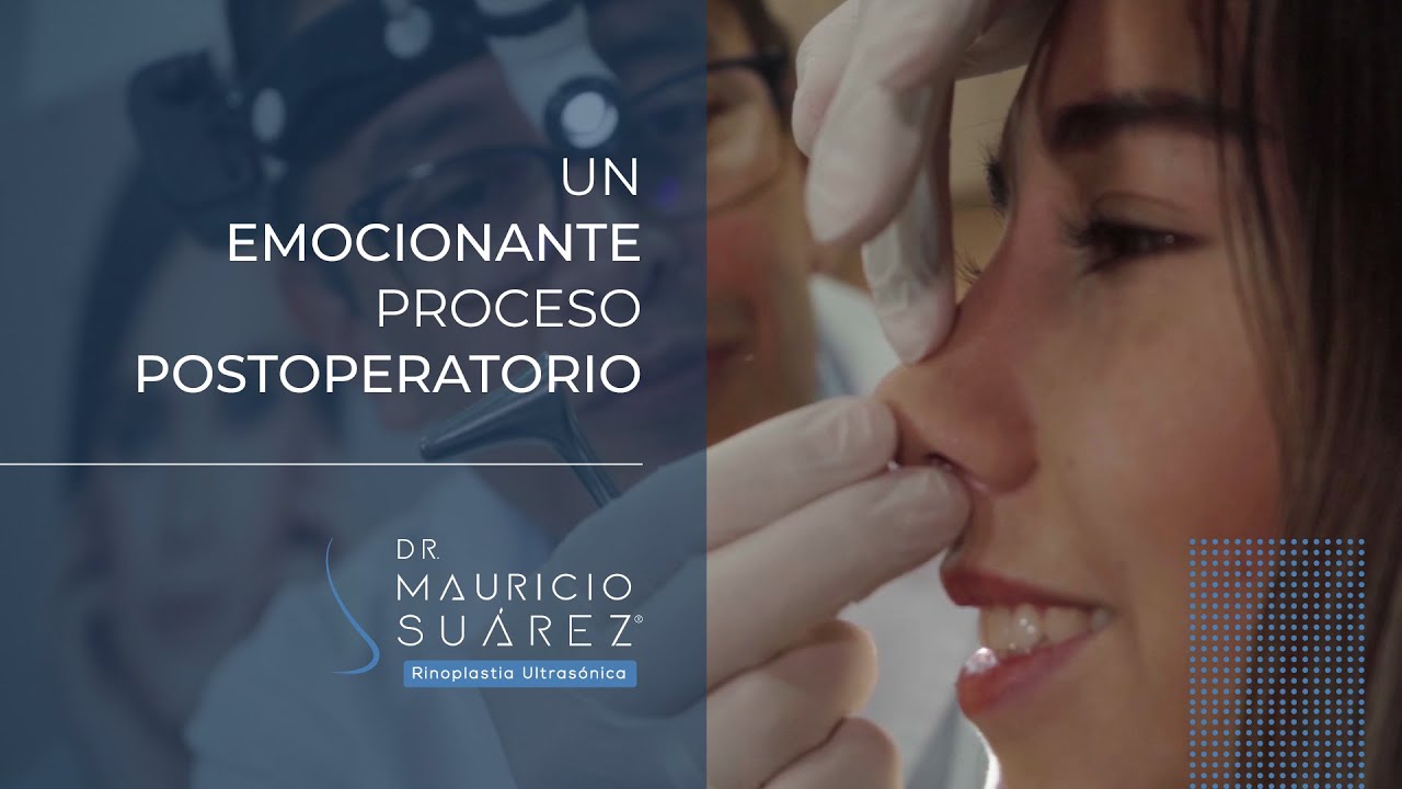 Un emocionante proceso postoperatorio en rinoplastia ultrasónica | Dr. Mauricio Suárez