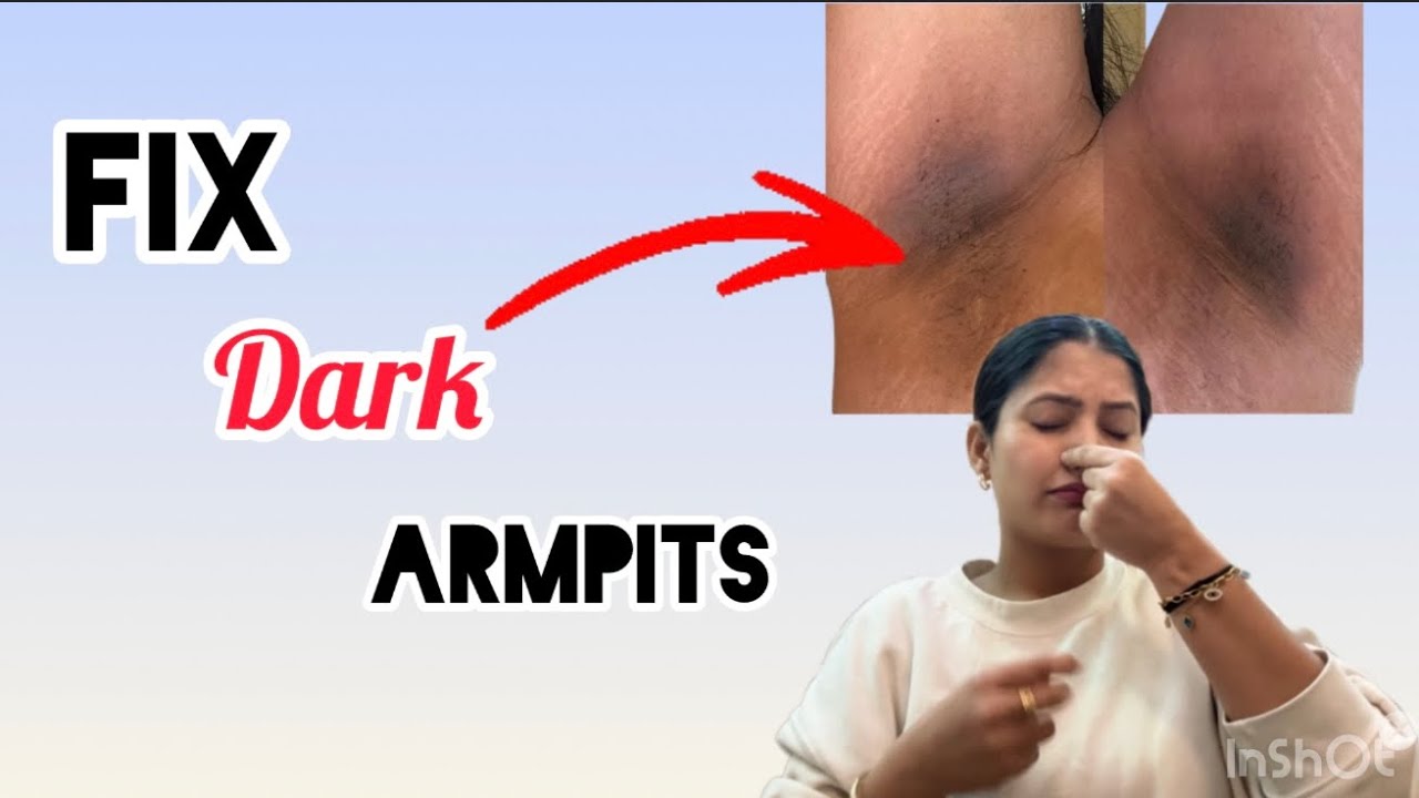 How to Remove Dark Underarms FAST | Best Underarm Routine for Bright & Smooth Skin | Mansi Sharma 