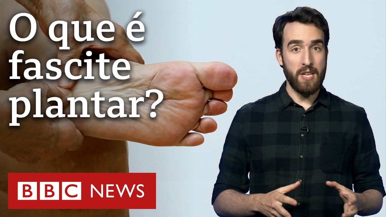 Fascite plantar: como tratar dor na sola do pé