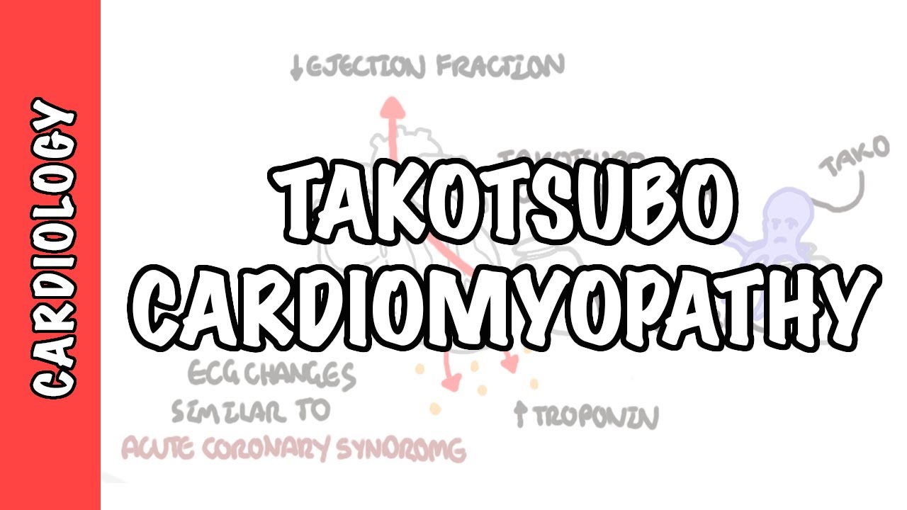 Takotsubo Cardiomyopathy (Broken heart syndrome) - pathophysiology, diagnosis and treatment