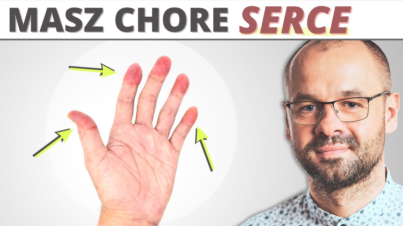 10 objawów chorego SERCA - widocznych gołym okiem