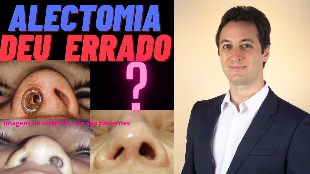 Alectomia deu errado:e agora?