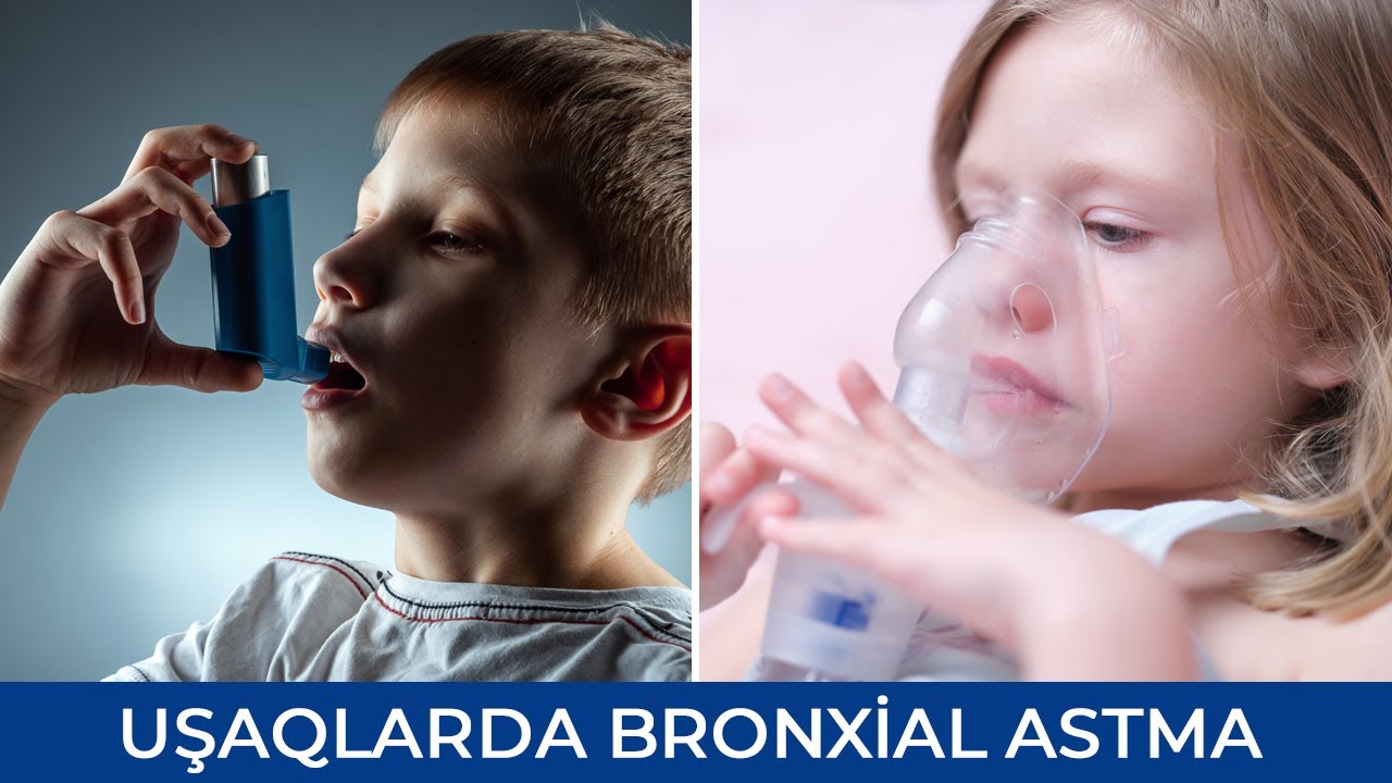 Uşaqlarda Bronxial Astma - Şəhla Mustafayeva ( Pediatr-allerqoloq )