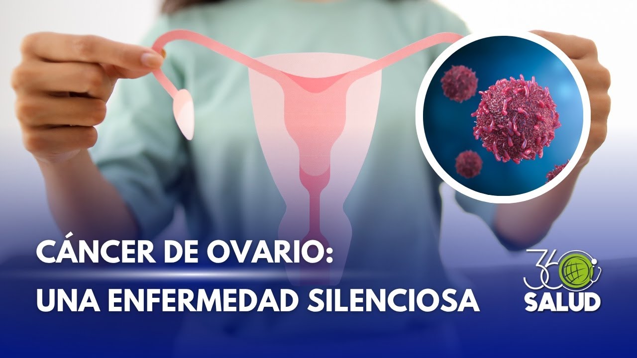 CÁNCER DE OVARIO: SEÑALES QUE NO DEBES IGNORAR