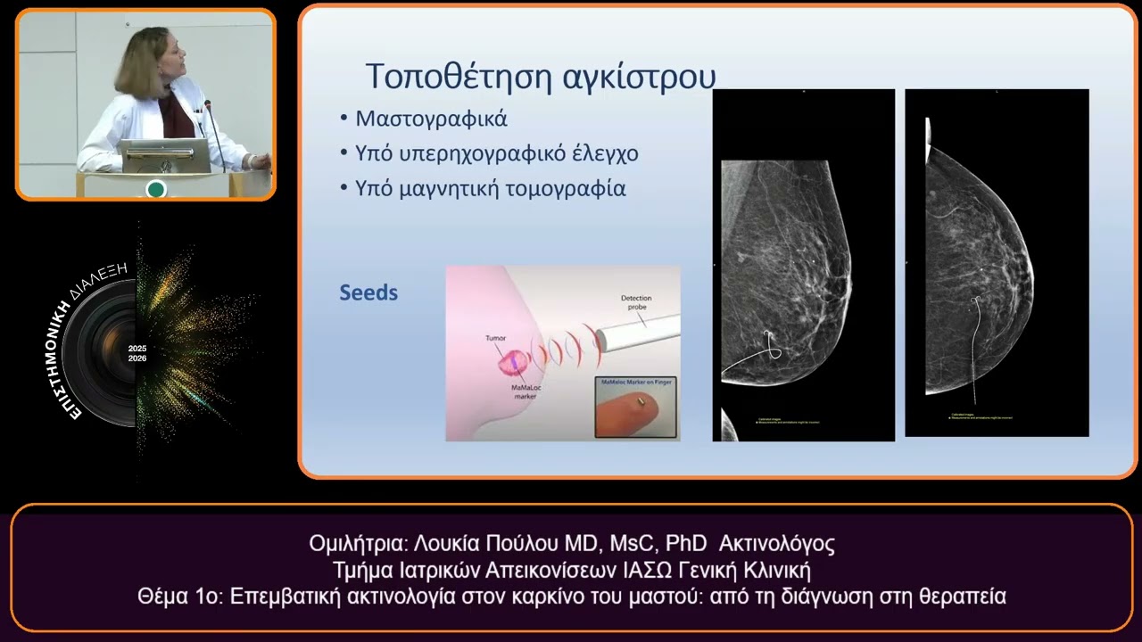 ΟΜΙΛΗΤΕΣ: Λουκία Πούλου MD, MsC, PhD Ακτινολόγος  , Καρράς Εμμανουήλ Ακτινολόγος