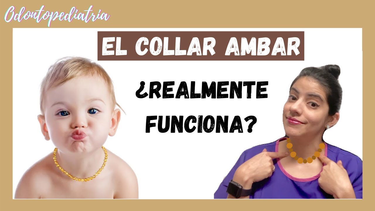 👉🏼El collar ambar realmente funciona?