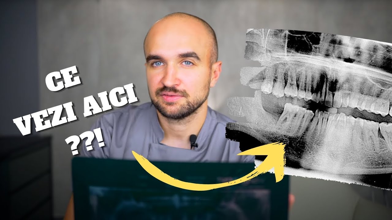 Învață Să Interpretezi o Radiografie Dentară