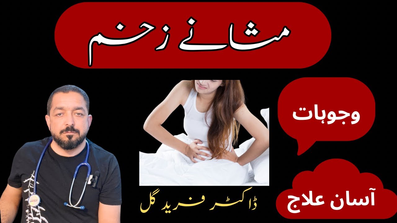 Easy way to deal cystitis ||مثانے کی زخم کا آسان علاج