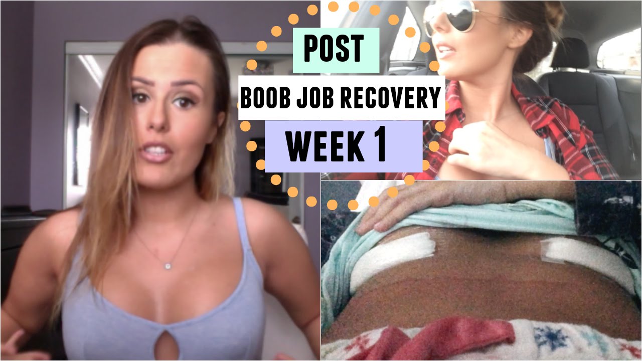 BOOB JOB RECOVERY WEEK 1: PUKING AND REGRETS?|Boob Vlog #6