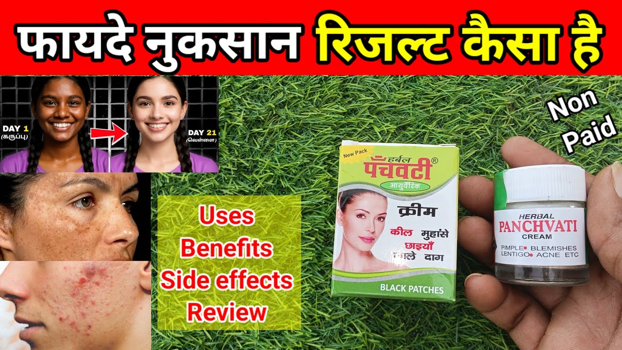 panchvati cream| panchvati cream review 2026, panchvati ayurvedic cream 
