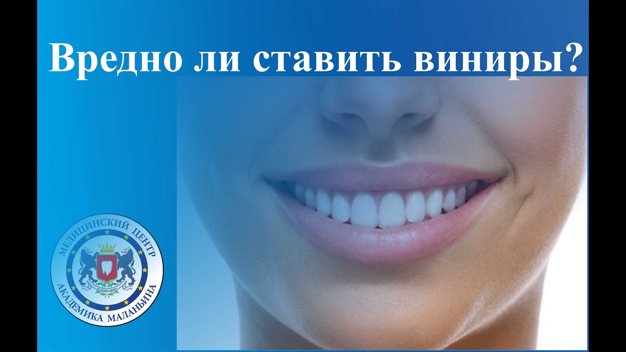 Вредно ли ставить виниры?