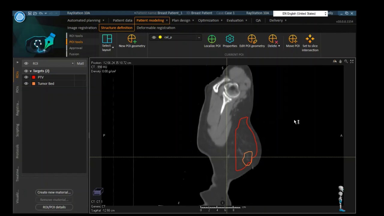3D-Breast planning With-without Wedges