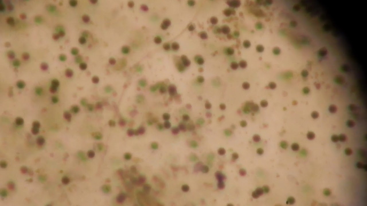 ciliate associated with wood frog eggs