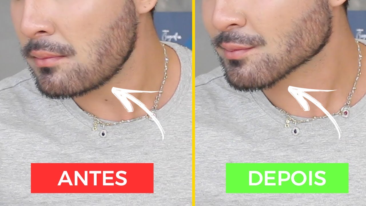 TOP 8 EXERCÍCIOS PARA DEFINIR MANDÍBULA E PERDER BOCHECHAS | DEIXE SEU ROSTO QUADRADO