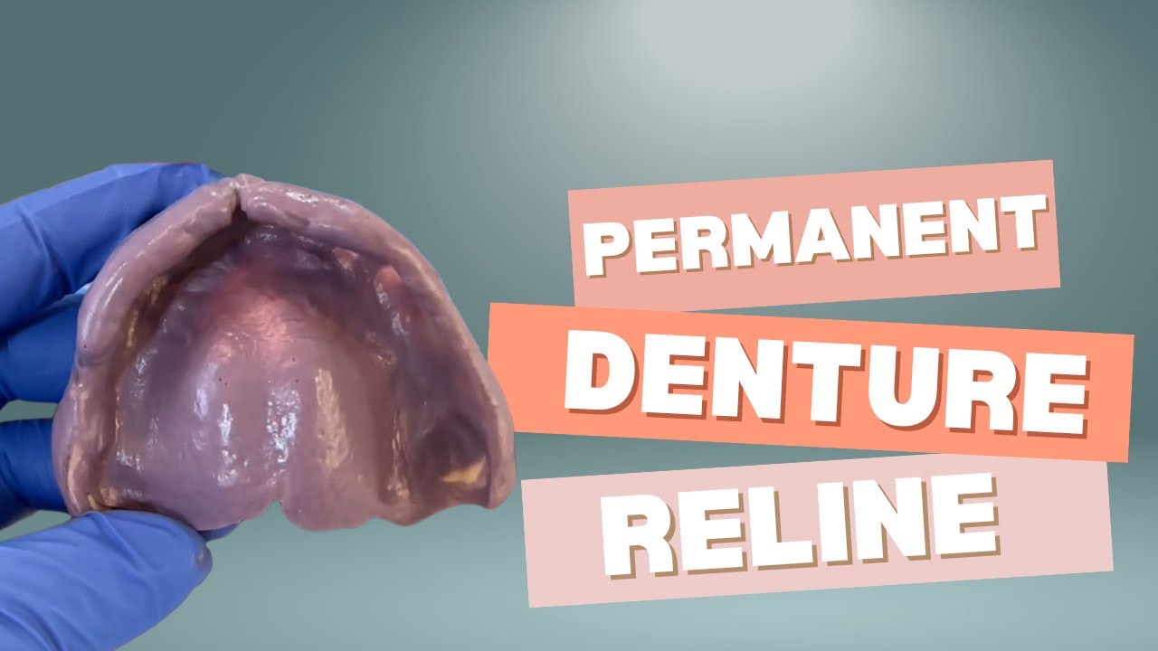 Conversion of Immediate Denture to Permanent Denture with Permanent Hard Reline