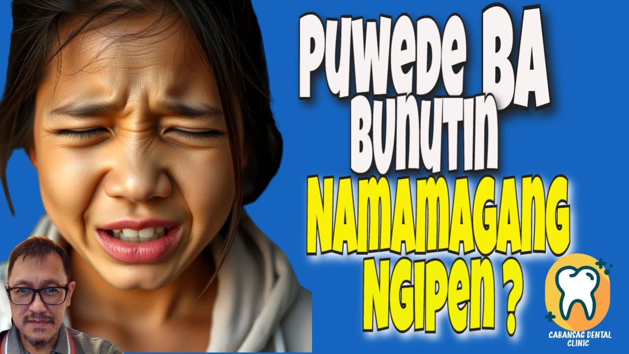 Puwede Ba Bunutin Namamagang Ngipin / wisdom tooth / Gamot