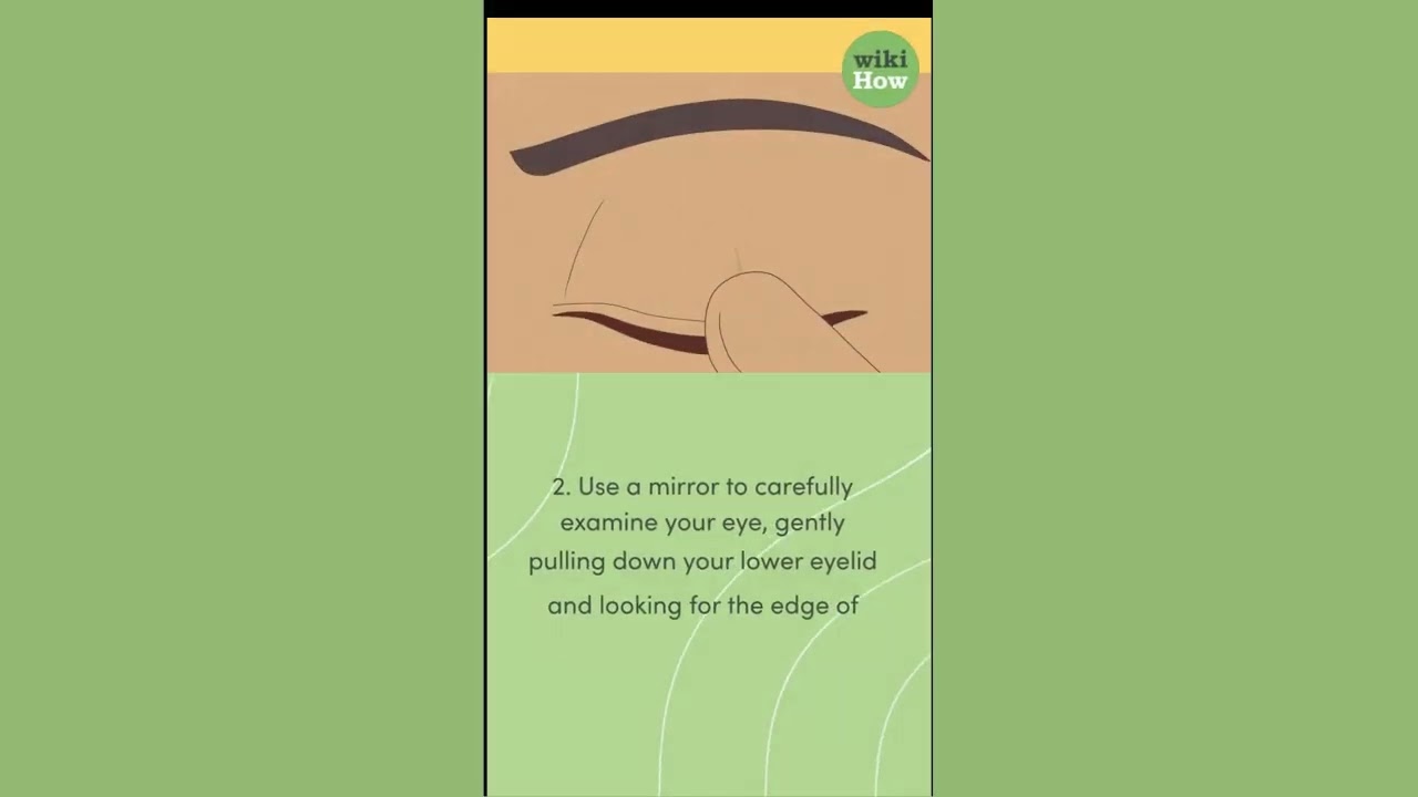 How To Tell if Contact Lens Is Still in Eye