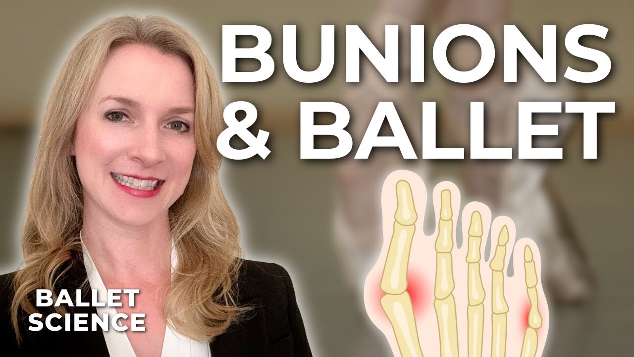Почему вальгусная деформация большого пальца стопы часто встречается у балерин