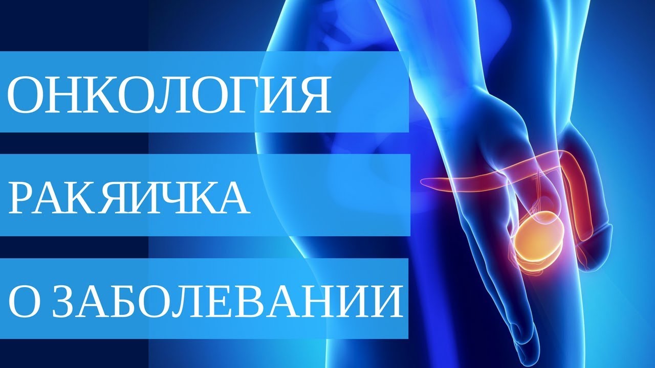 РАК ЯИЧКА - причины ➤ диагностика ➤ лечение 💉💊