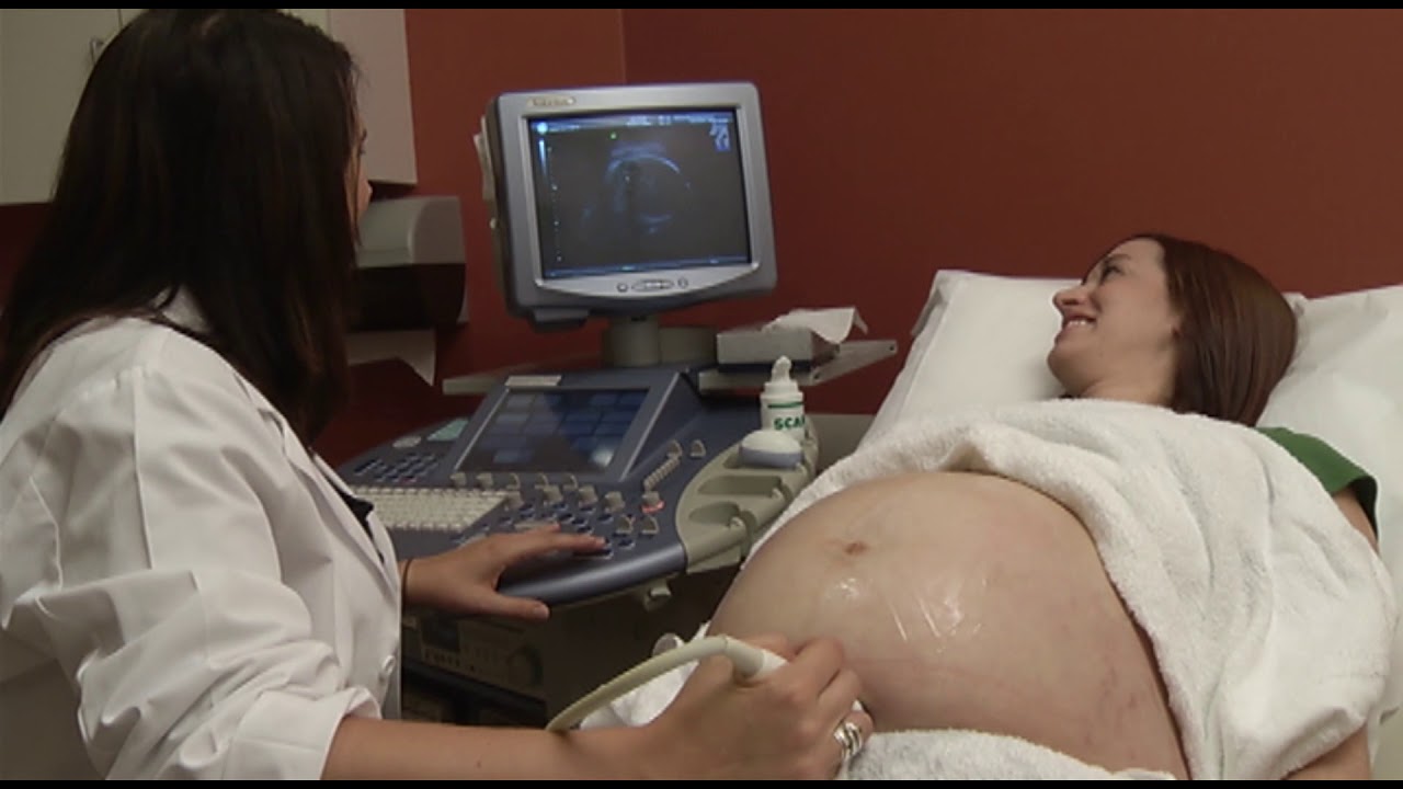 CONGENITAL HEART DEFECTS IN BABIES