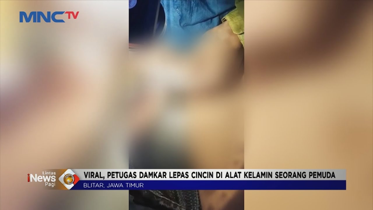 Lepaskan Cincin di Alat Kelamin, Pemuda di Blitar Minta Tolong ke Damkar #LintasiNewsPagi 04/03