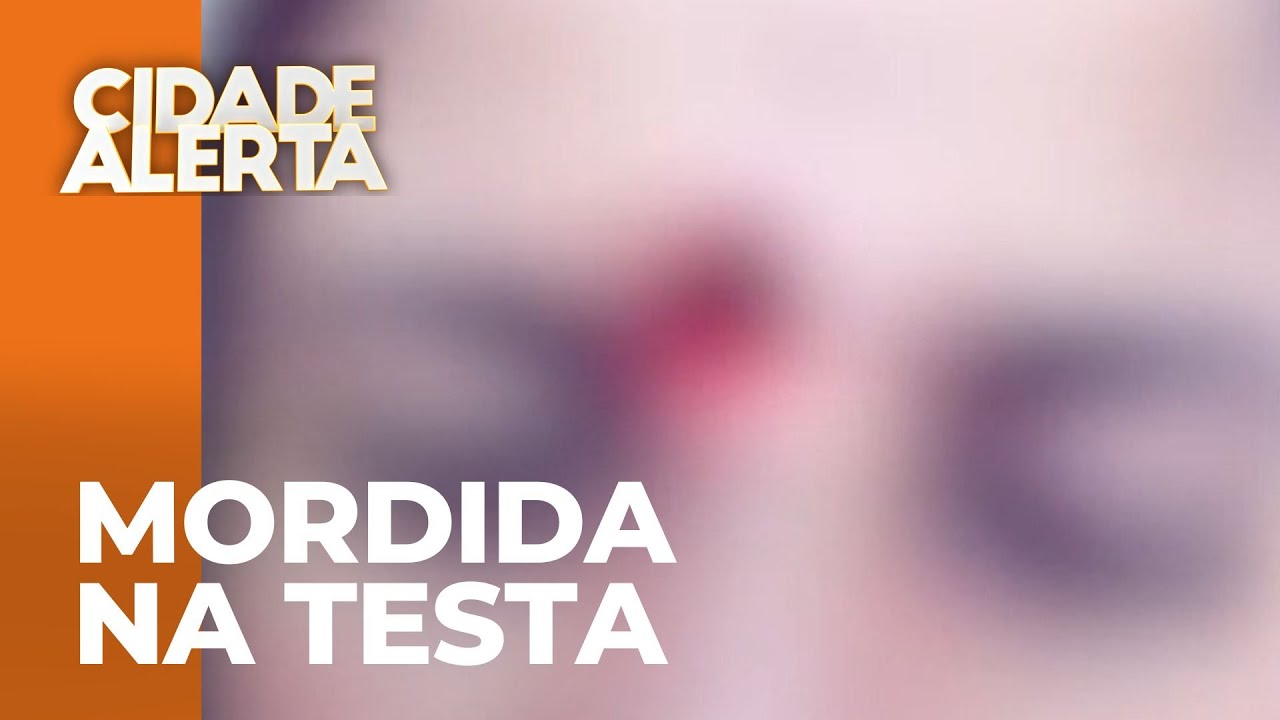 Mulher morde a outra na testa por ciúmes durante confusão em churrasco