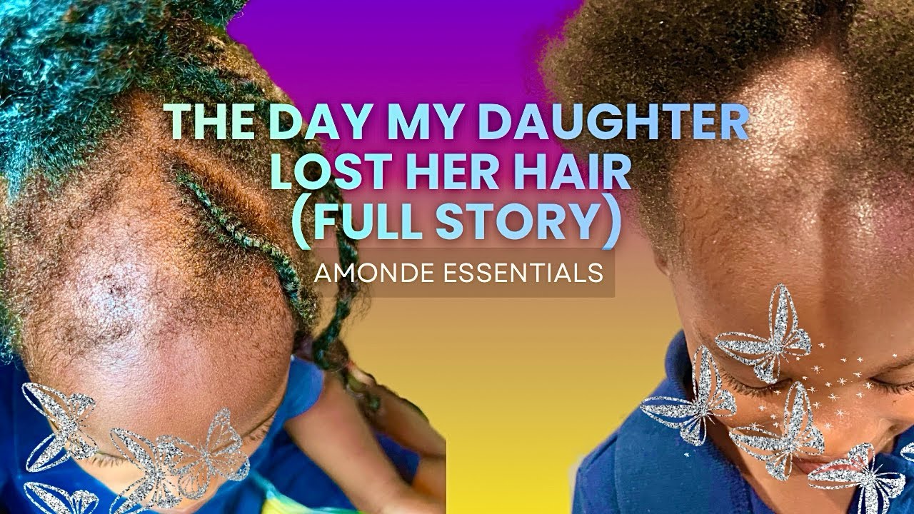 I Trusted This Daycare… My Daughter Ended Up Losing Her Hair
