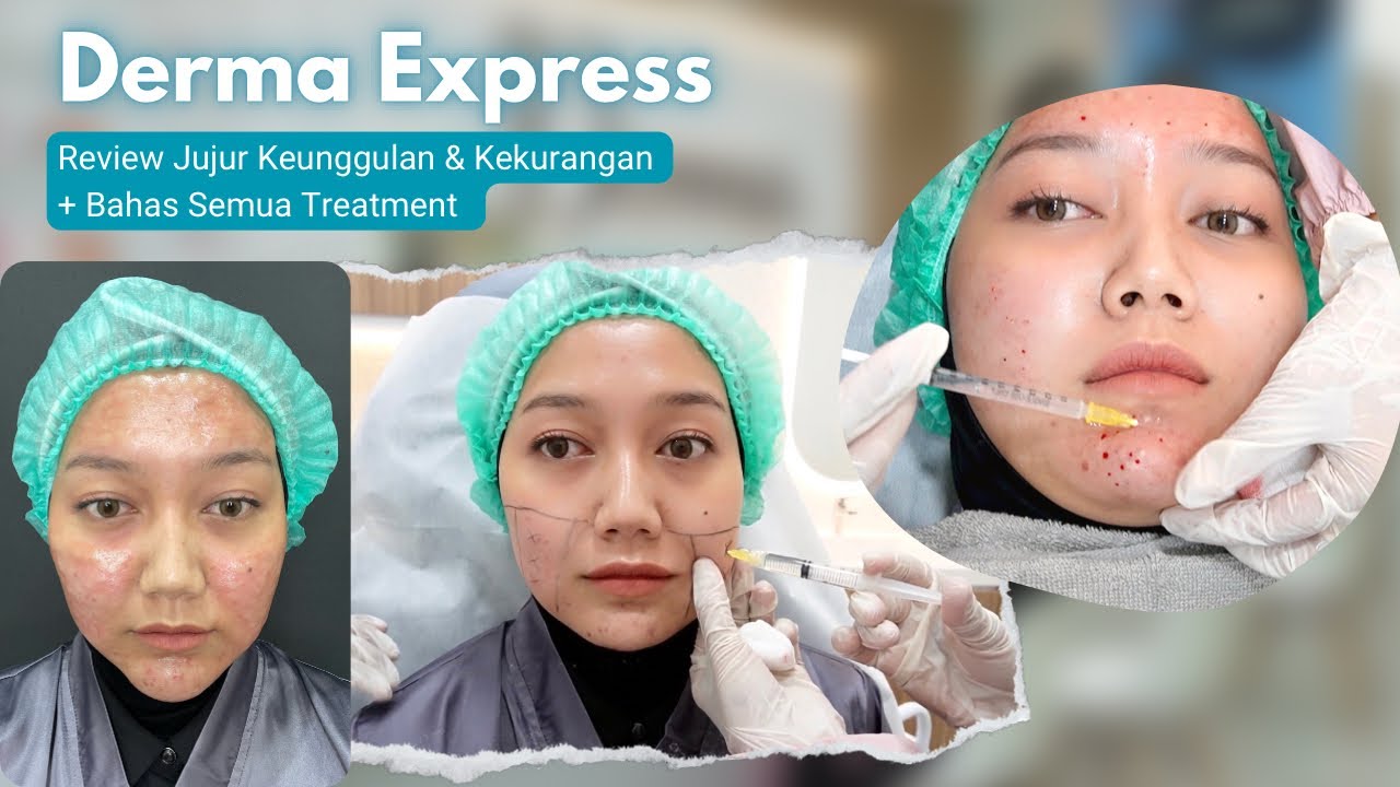 Kupas Tuntas Perawatan di Derma Express | Harga? (BBC) Bahas Beauty Clinic eps 1