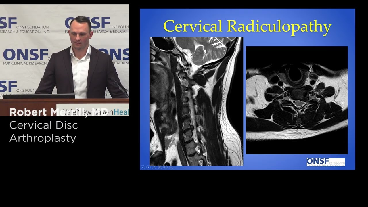 Robert Merrill, MD -  Cervical Disc Arthroplasty