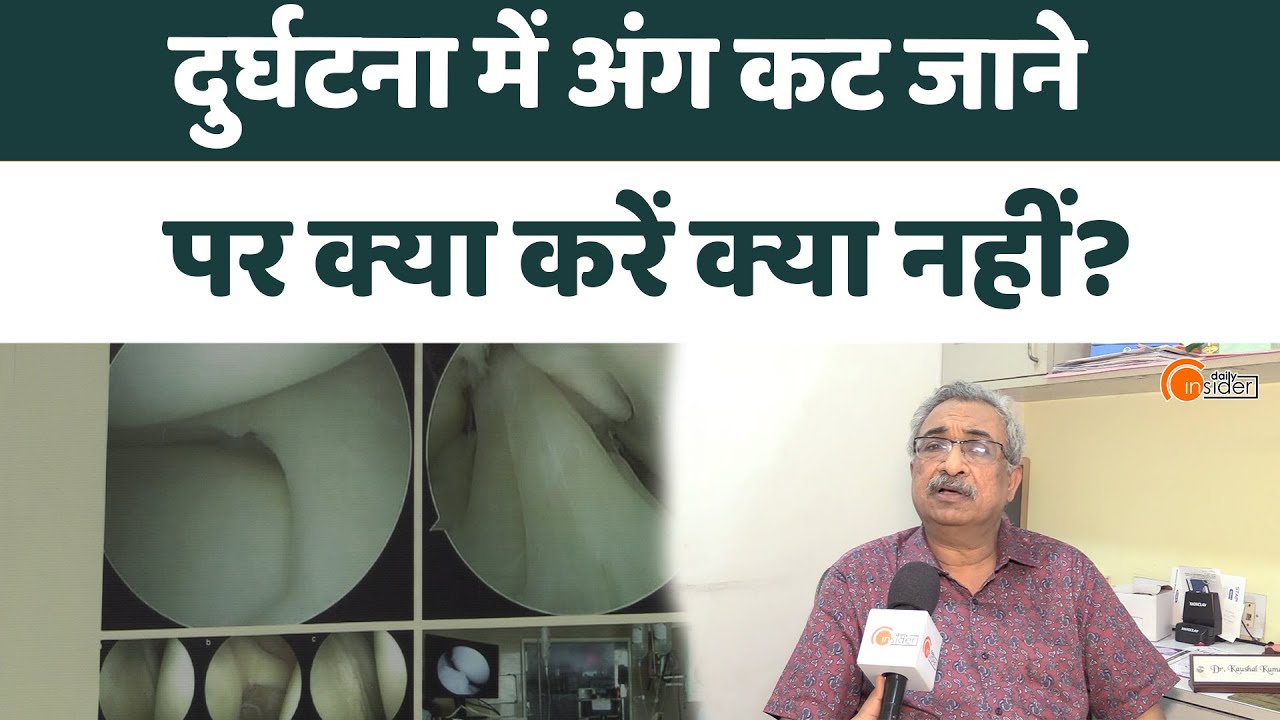 Eshan Hoshpital Bareilly के संस्थापक Dr. Kaushal Kumar ने दिए महत्वपूर्ण टिप्स