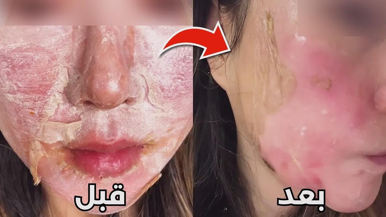 الخداع وراء روتين العناية بالبشرة الخاص بك