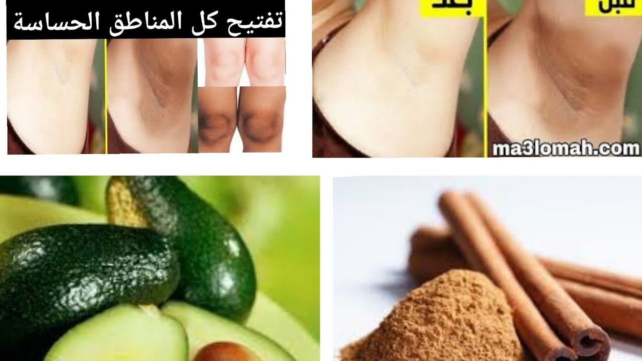 الوصفة القنبلة لتفتيح المناطق الحساسة من اول استعمال والنتيجة روعة 👍👍